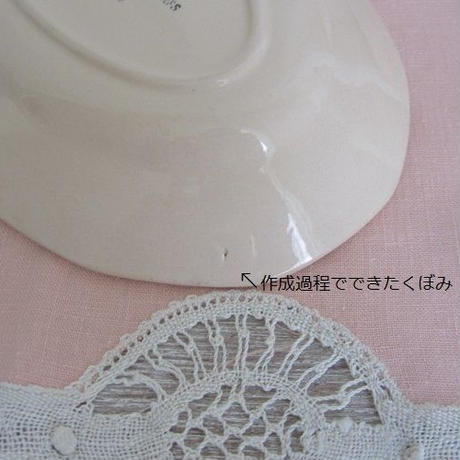 5ae8ab87434c72224a000946