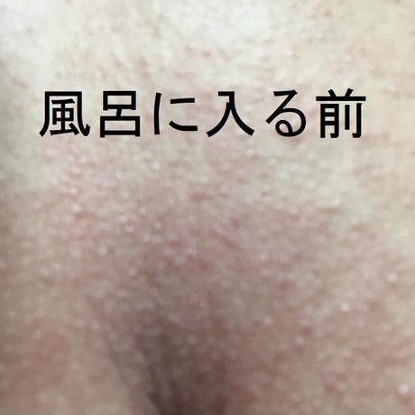 5ae9a7295f786641d8000973