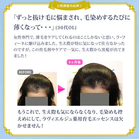 5c7a1ecba9ac4c69ee5c9912
