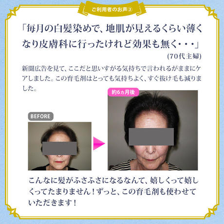 5c7a1ecba9ac4c69ee5c9912