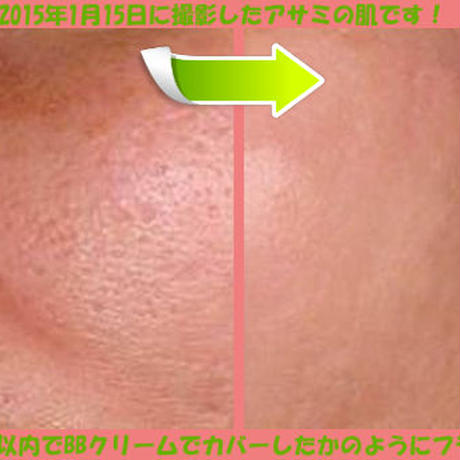 5472a6b186b1886595000167