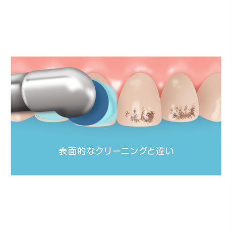554aea37ef3377ffeb000a2d