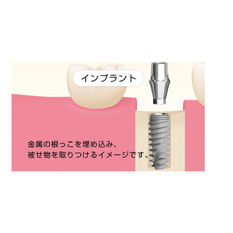 52e9ec5a236a1e0b9100008c