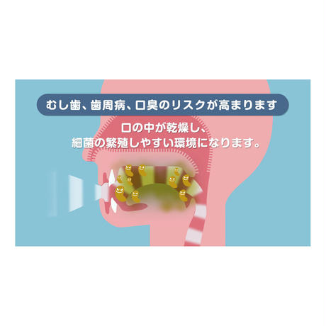 56b455283bcba98ea80008a4