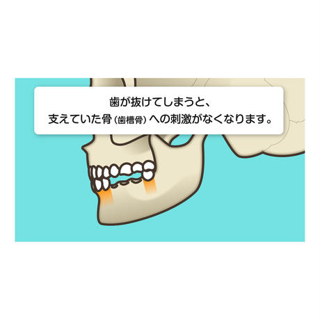 53634d79236a1e8f6500001a