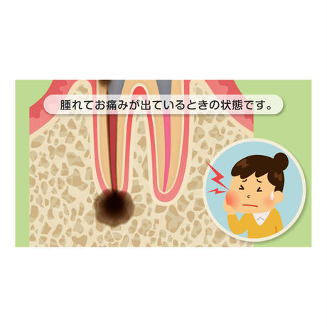 56b455283bcba98ea80008a4