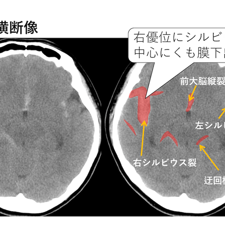 5d0b20d97521797c94b8117d