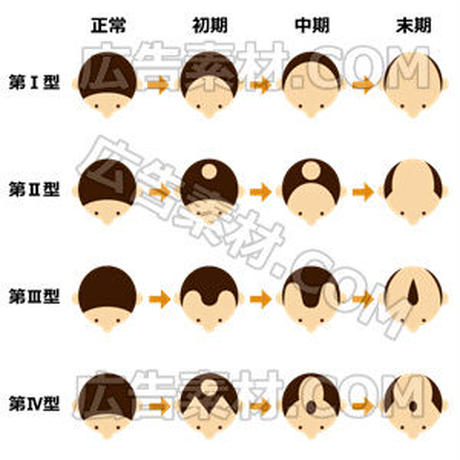 5c614ab3787d8413762f4ef2