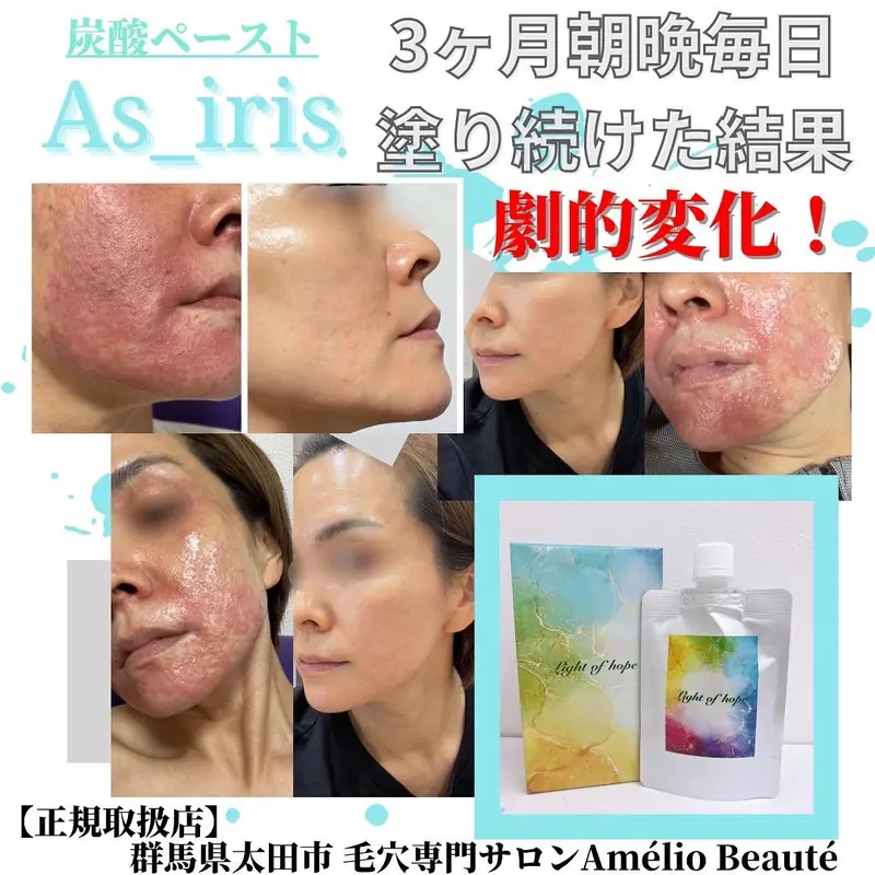 アズイリスAsiris 炭酸ガスパック2個セット