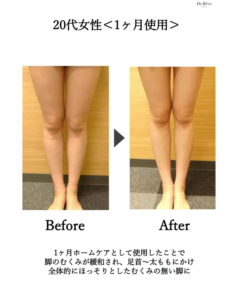 サロン専用 定価13200円 ドクターレーヴ メディケア ボディシェイプ