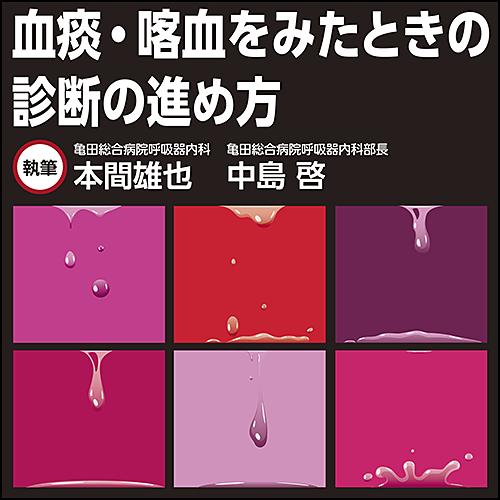 血痰 喀血をみたときの診断の進め方 日本医事新報社 Webコンテンツ販売サイト