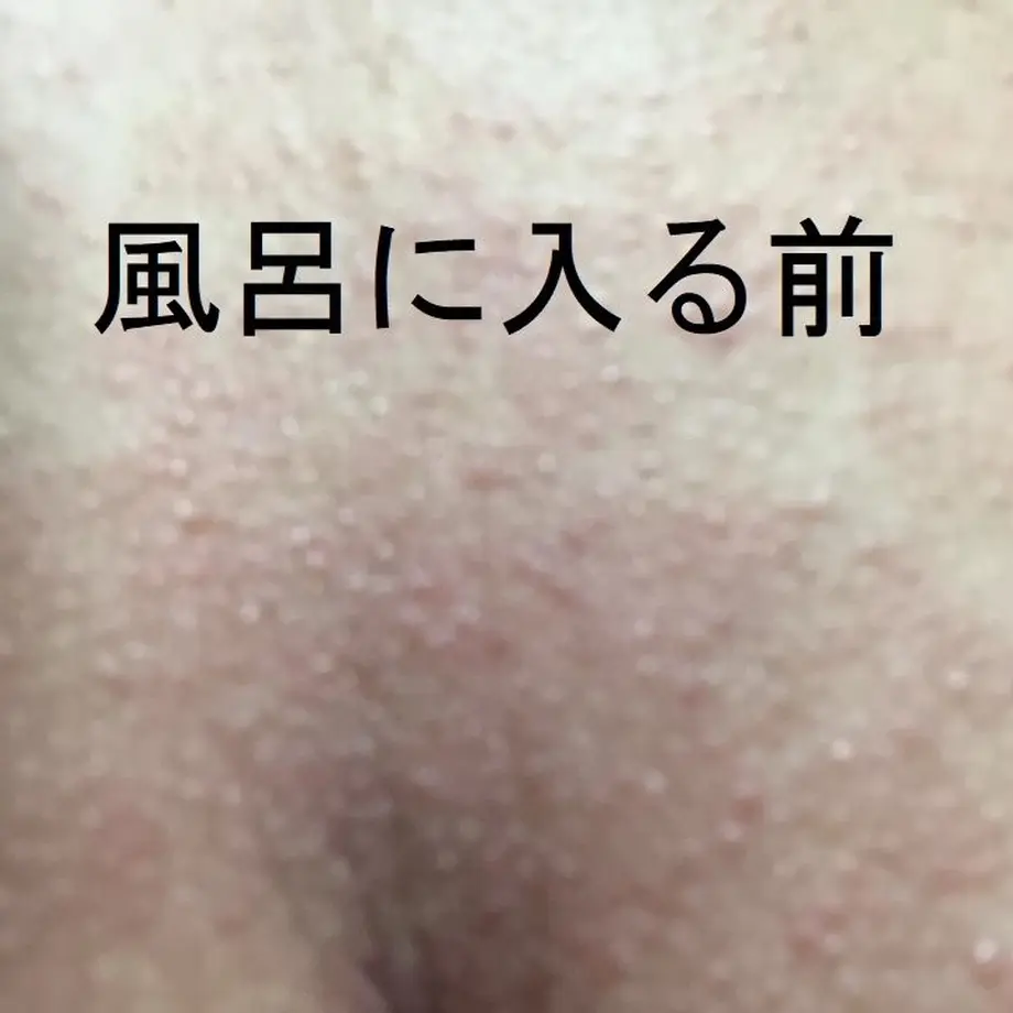 5ae9a7295f786641d8000973