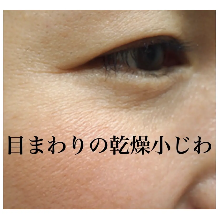 5ee1af1051576203dd9f9219
