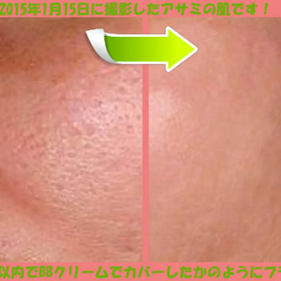 5472a6b186b1886595000167