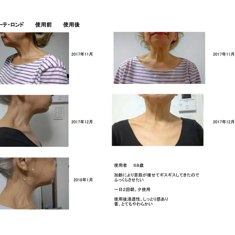 5a9768225f78660fb8001268