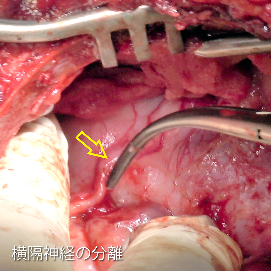 61d174bcfd2e735fb4407dc8