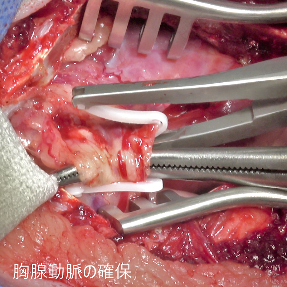 61d174bcfd2e735fb4407dc8