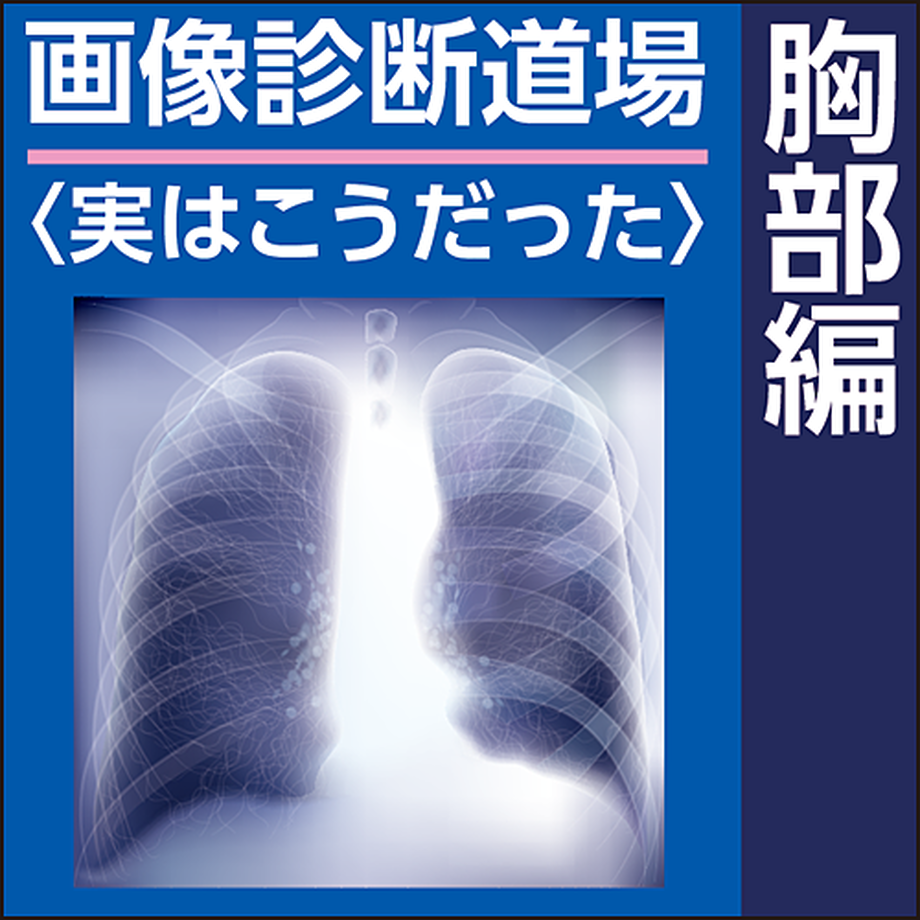 5ce75113adb2a13d0d57ab33