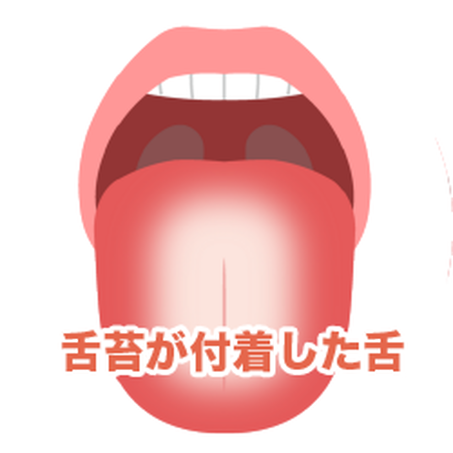 5eeffe10d26fa52a164b74c3