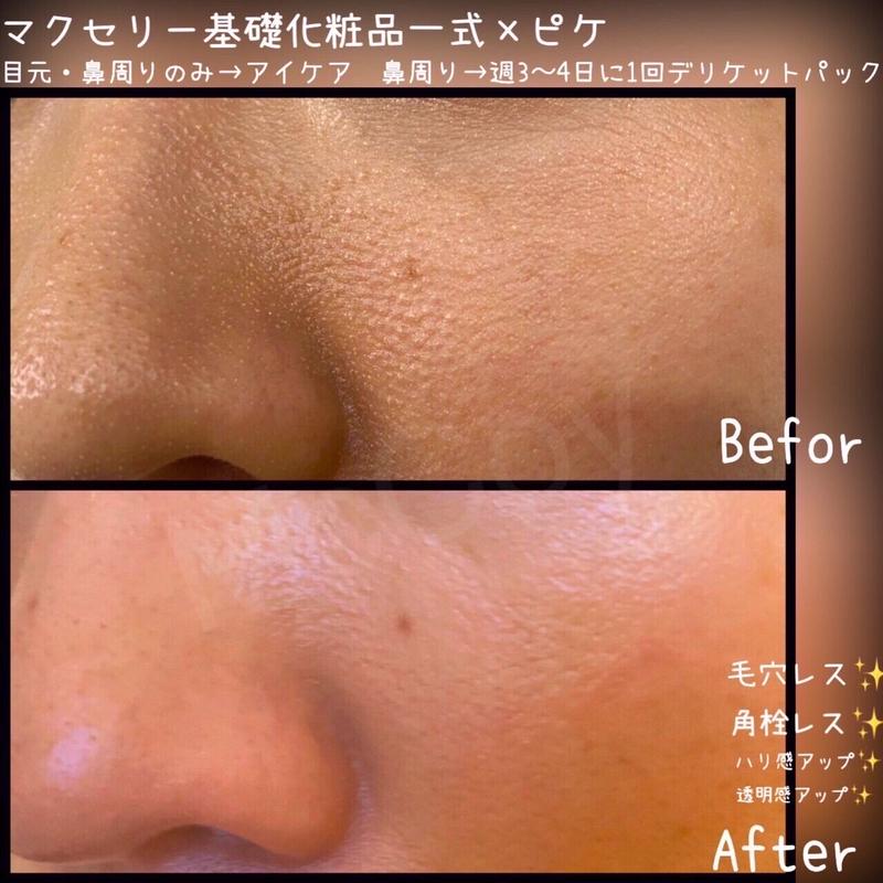 コンパクト マクセリーピケ H4PZD-m84709535523 ナイトケア