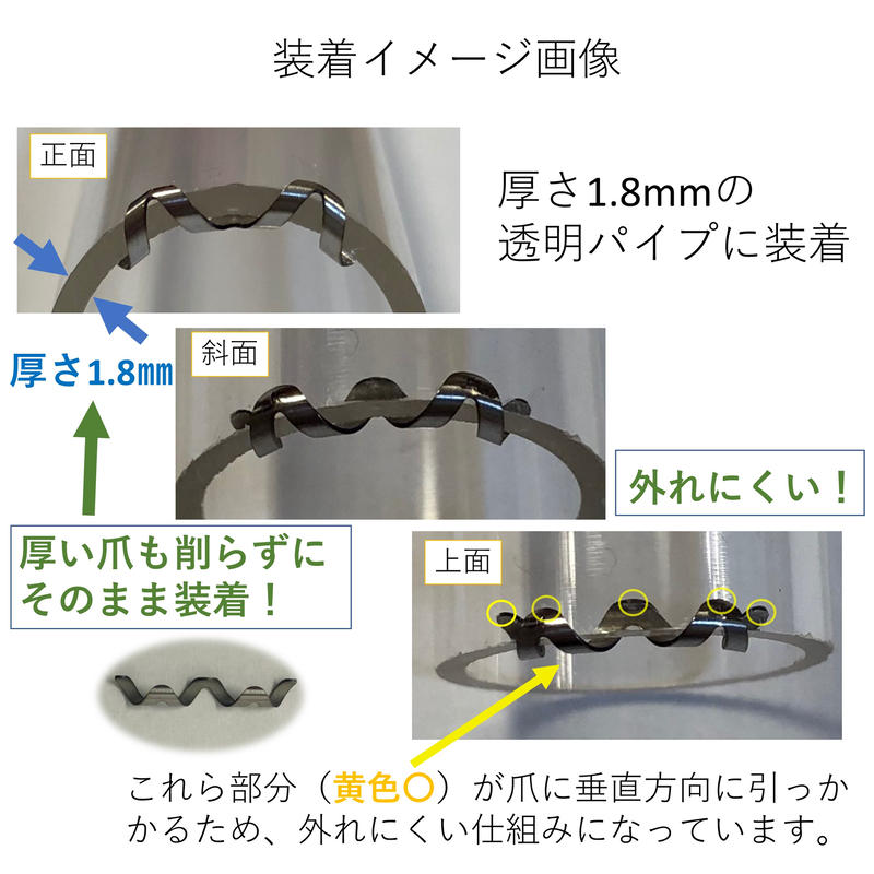 ネイル エイド １４ｍｍ 巻き爪矯正 巻き爪治療 ブロック ロボ ガード リフト ワイ