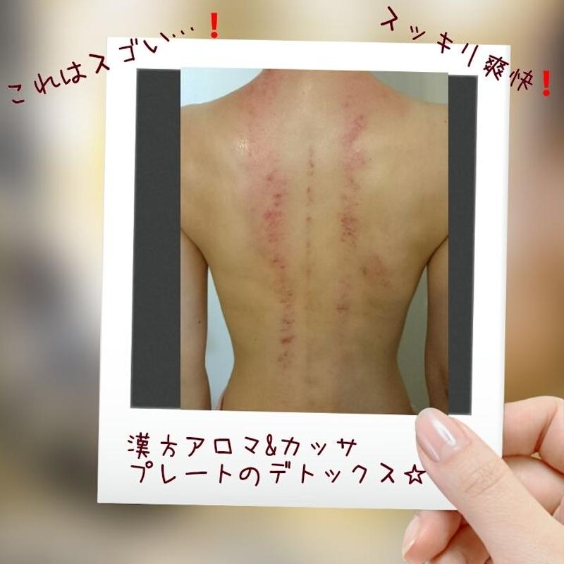 漢方研究の中枢台湾国立陽明大学から生まれた最新技術 漢方精油 神気 を使用した カッサ排毒トリ 漢方研究の中枢台湾国立陽明大学から生まれた最新技術 漢方精油 神気 を使用した カッサ排毒トリ