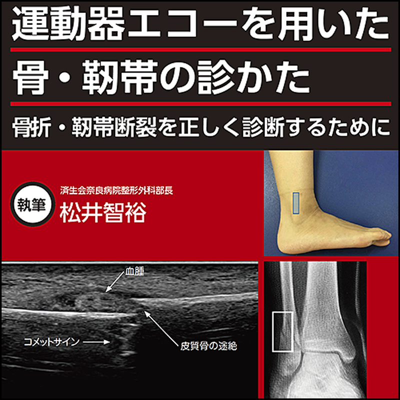運動器エコーを用いた 骨 靱帯の診かた 骨折 靭帯断裂を正しく診断するために 日本医事新報 運動器エコーを用いた 骨 靱帯の診かた 骨折 靭帯断裂を正しく診断するために 日本医事新報