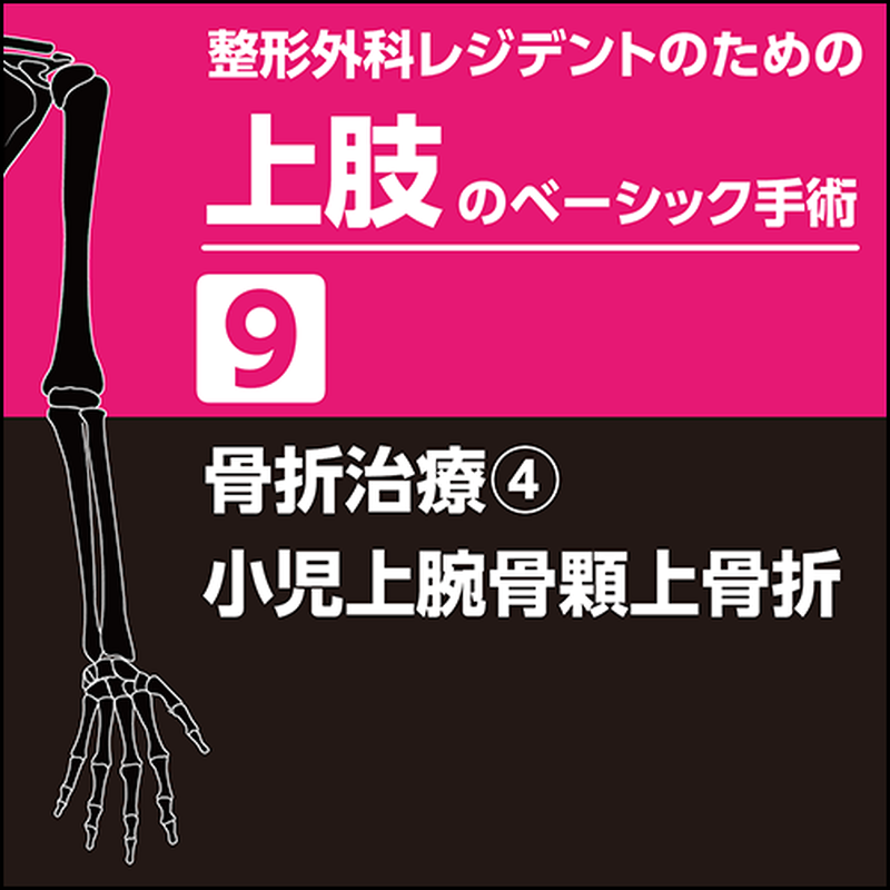 裁断済】小児四肢骨折治療の実際 第2版（裁断済】小児四肢骨折