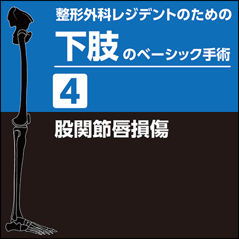 整形外科レジデントのための下肢のベーシック手術4 股関節唇損傷 Pdf版 日本医事新報社
