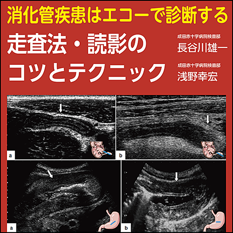 消化管疾患はエコーで診断する〜走査法・読影のコツとテクニック