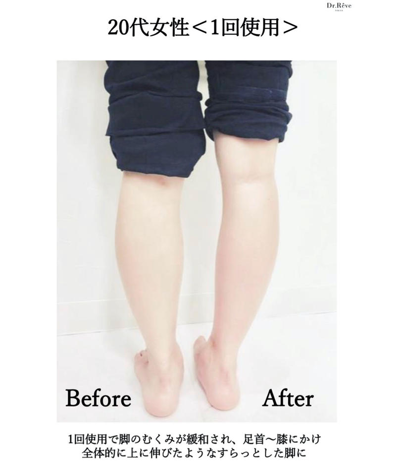 塗る脂肪溶解注射 メディアボディシェイプ スリミングクリーム Qanael Beaut 塗る脂肪溶解注射 メディアボディシェイプ スリミングクリーム Qanael Beaut
